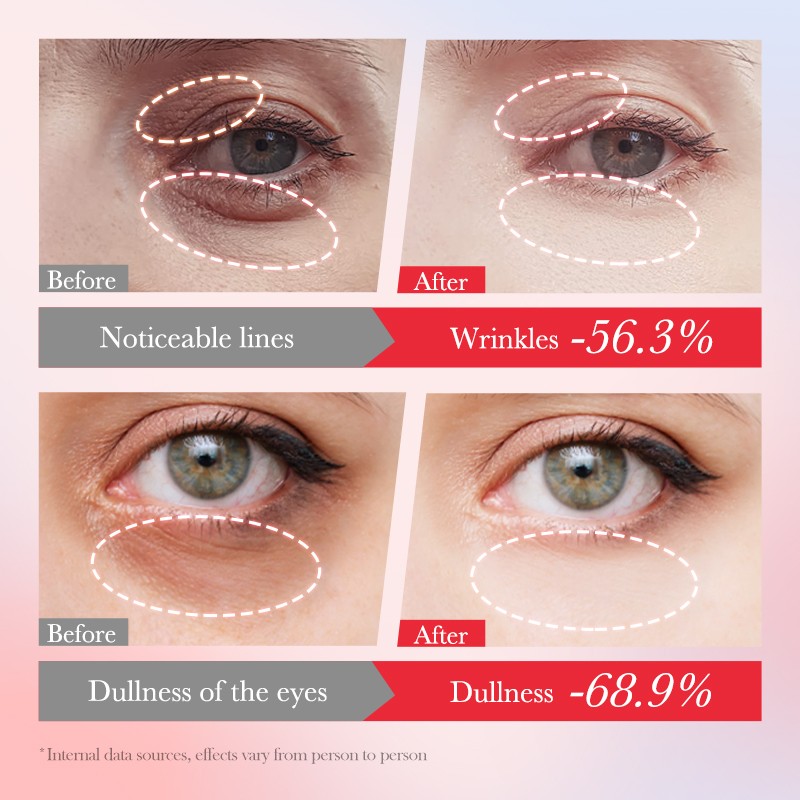 Eye Cream Factory - OEM Lycium Barbarum Firming