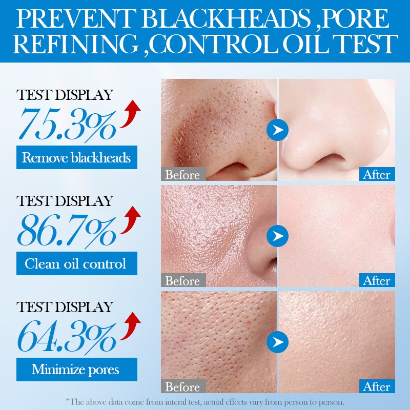 Clay Mask Manufacturer - OEM Dead Sea Mud Deep Cleansing