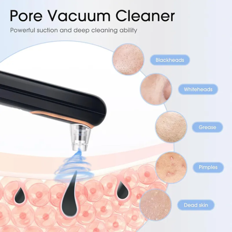 Blackhead Remover Manufacturer - OEM High-Efficiency Safe Painless Facial Vacuum
