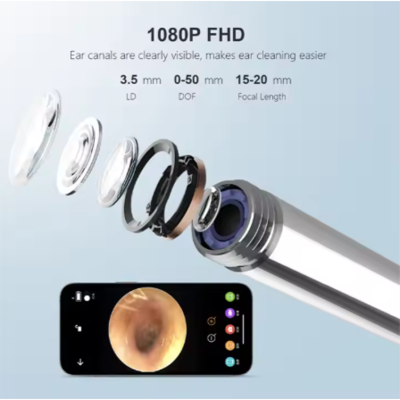 Portable Otoscope Manufacturer - Bulk WiFi-Connected Stainless Steel Silicone Home Use