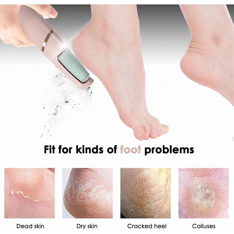 Electric Foot File Manufacturer - OEM Rechargeable Callus Remover