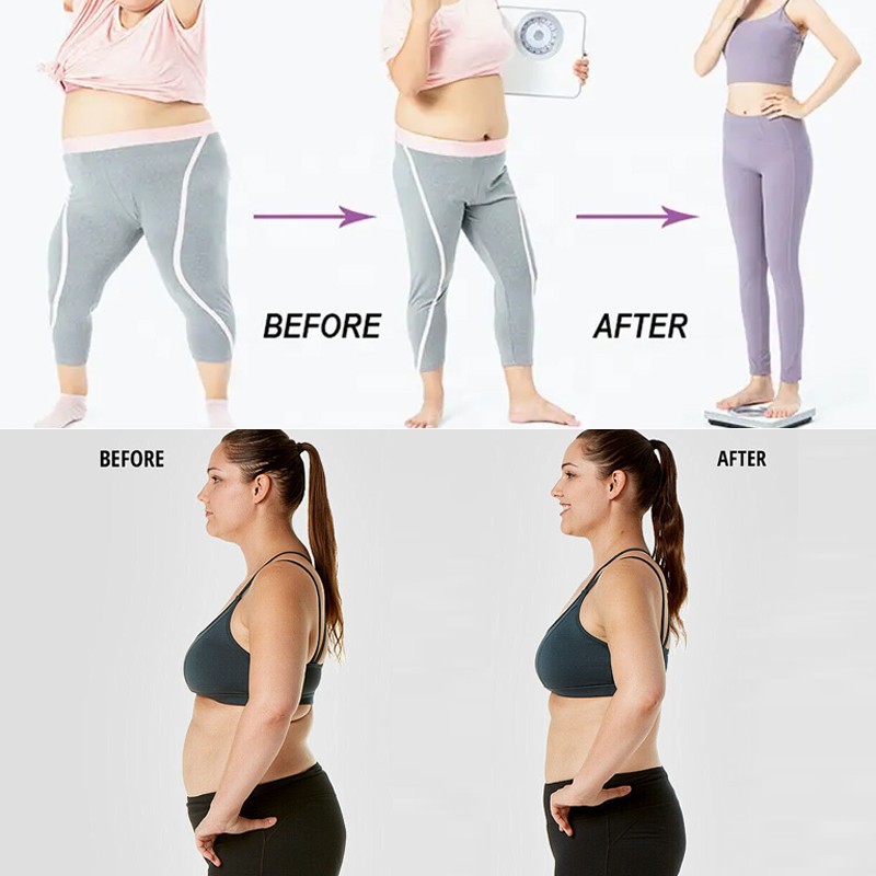 Garcinia Capsule Factory - OEM Natural Herbal Slimming