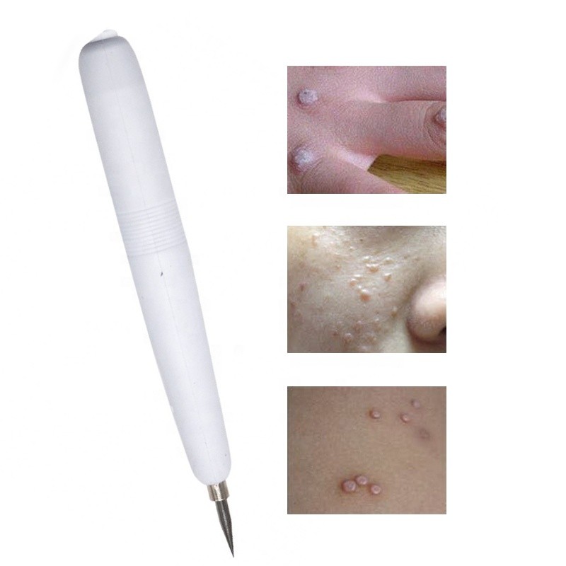 Plasma Pen Factory - OEM Maglev Spot Remover