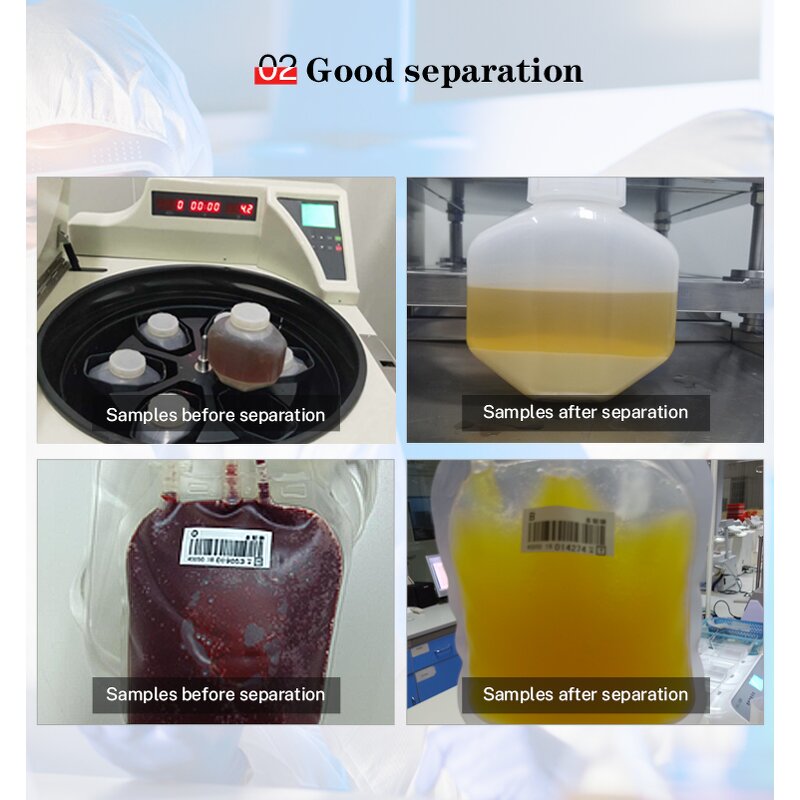 Blood Bank Refrigerated Centrifuge Manufacturer - OEM DL6M Laboratory