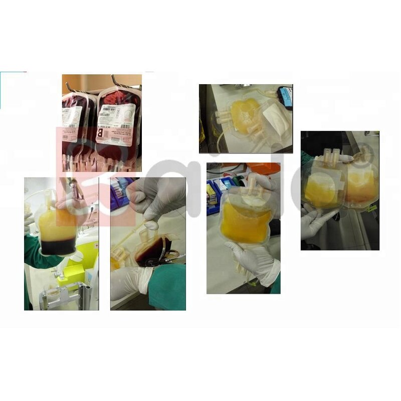 Blood Bag Separation Centrifuge Supplier - OEM Large Capacity Refrigerated