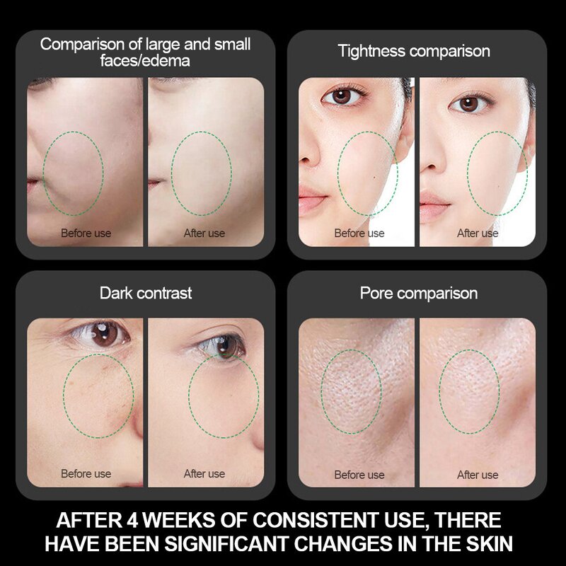 Ultrasonic Skin Scrubber Factory - Wholesale Portable Sonic Ultrasonic Peeling