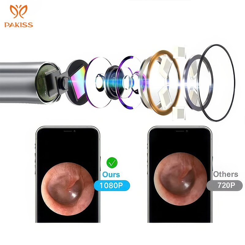 Visual Ear Cleaner Kit Manufacturer - Smart Kit Built-in Apps Wireless Waterproof
