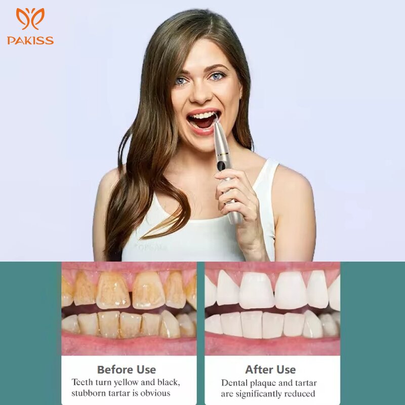 Ultrasonic Dental Scaler Manufacturer - Teeth Whitening Calculus Remover Tartar Device