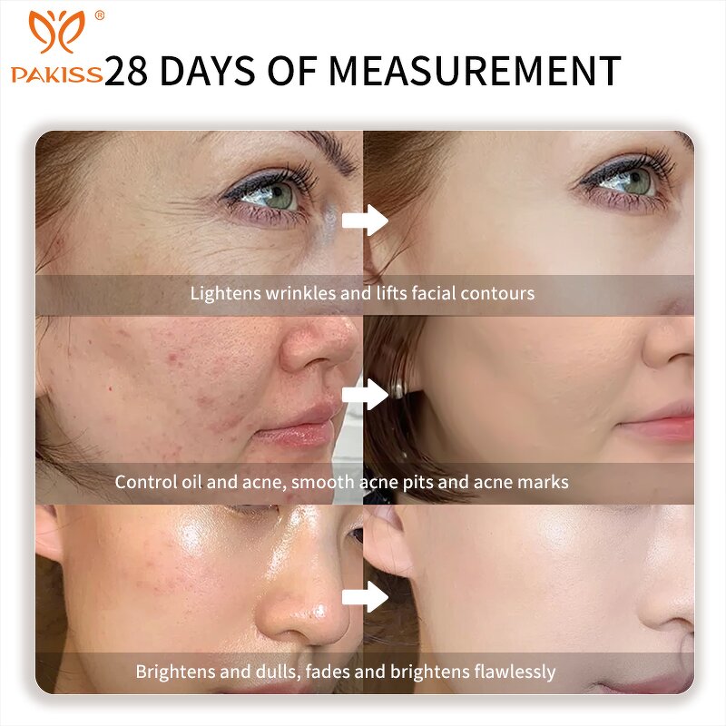 LED Face Mask Factory - Wholesale Electric Wireless Multi-Color