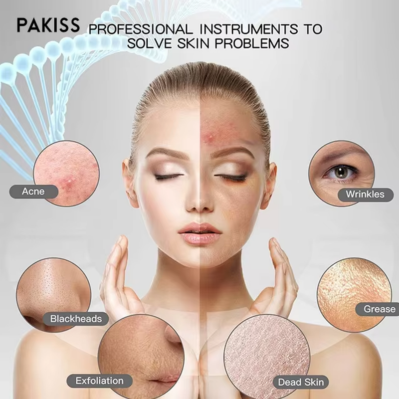 Ultrasonic Ion Skin Scrubber Manufacturer - Pink Color Spatula Peeling Shovel