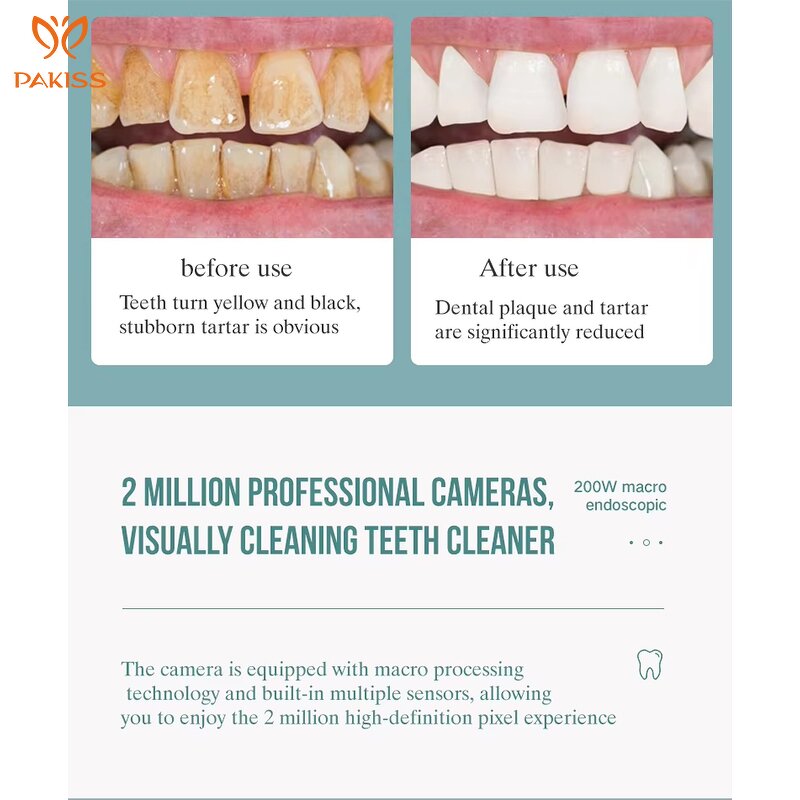 Ultrasonic Dental Scaler Manufacturer - Teeth Whitening Calculus Remover Tartar Device