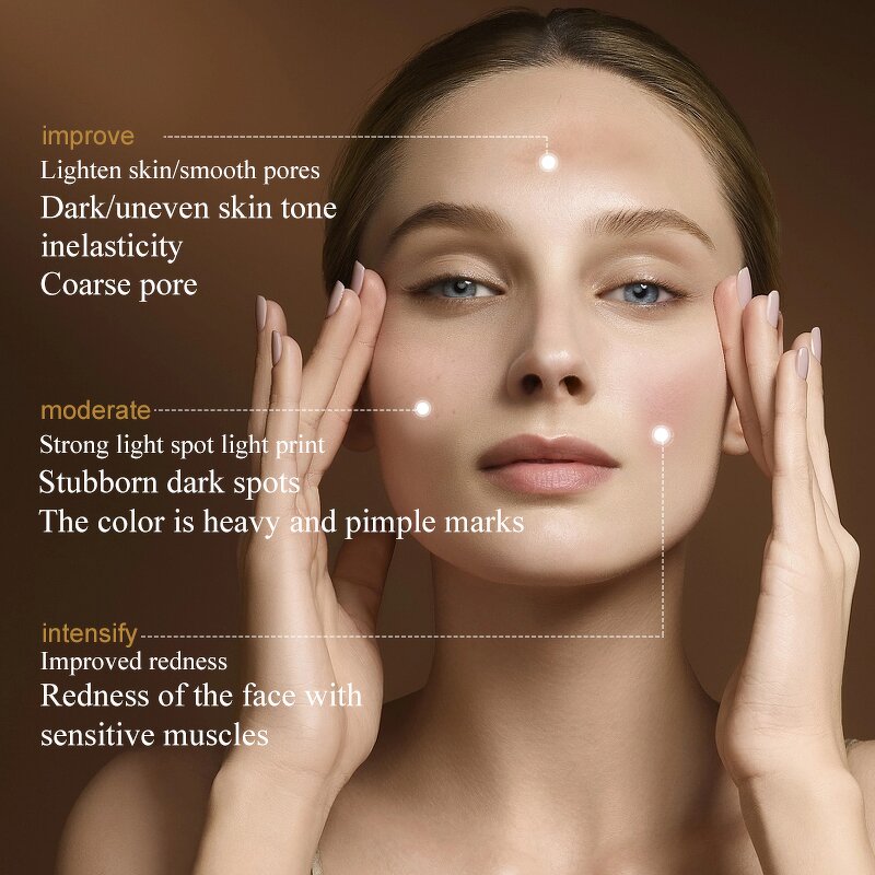 DPL Photofacial Device Manufacturer - PRO Skin Whitening Brightening