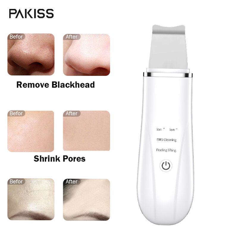 Ultrasonic Scrubber Manufacturer - USB Rechargeable Skin Spatula Peeling Blackhead