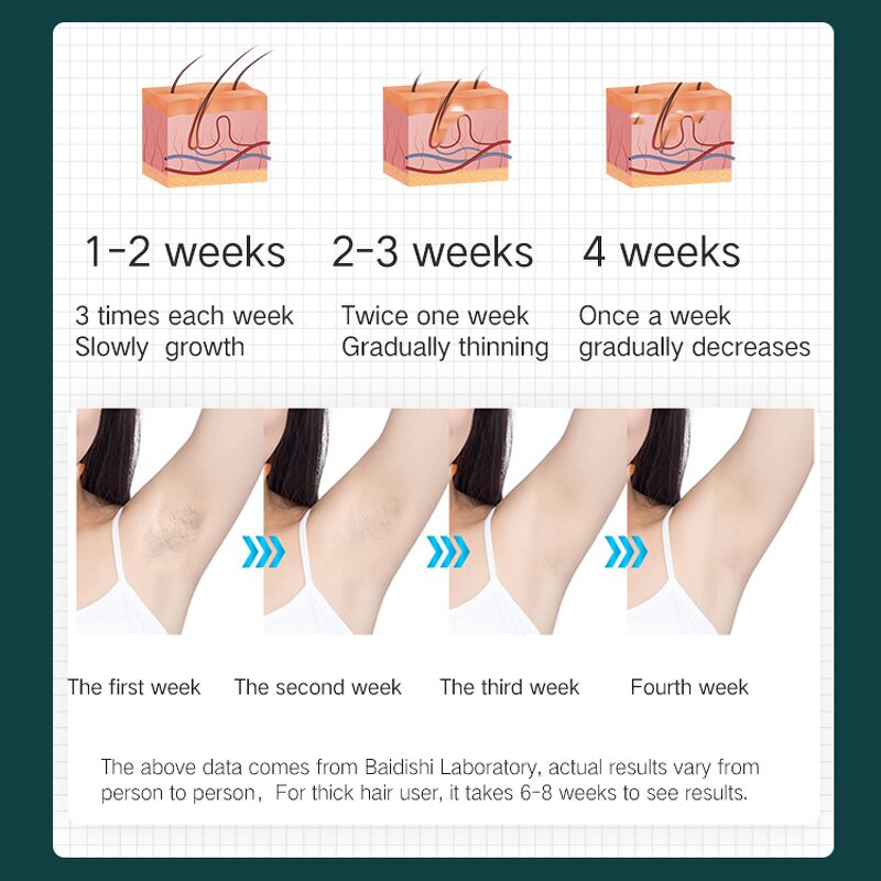 IPL Hair Removal Machine Manufacturer - OEM Portable Handheld for Body Face