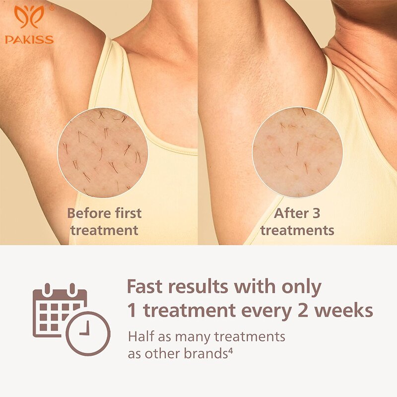 Battery IPL Hair Removal Device Manufacturer - Portable for Body Face