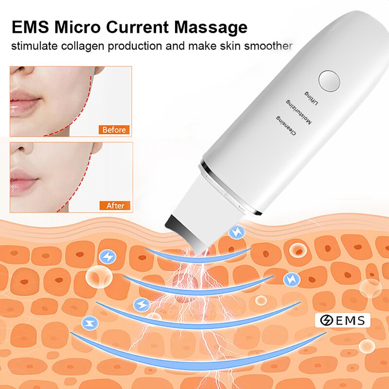 Facial Scrubber Factory - Wholesale Extractor With 4 Modes Spatula