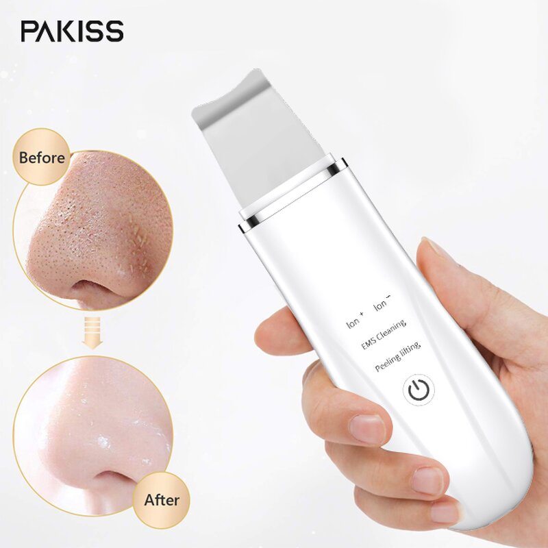 Ultrasonic Scrubber Manufacturer - USB Rechargeable Skin Spatula Peeling Blackhead