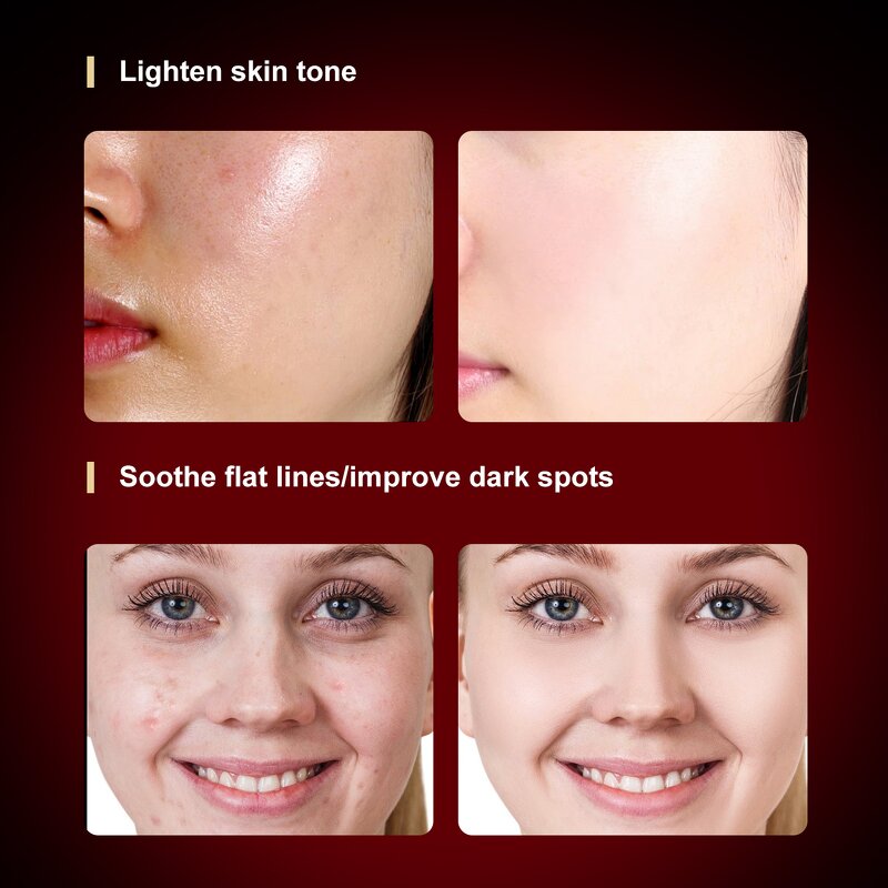 Skin Tightening Light Therapy Panel Manufacturer - Facial Photon Rejuvenation Advanced