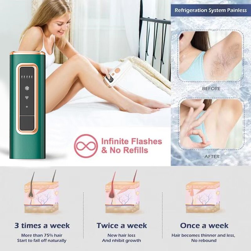 IPL Hair Removal Device Factory - New Design Electric Permanent