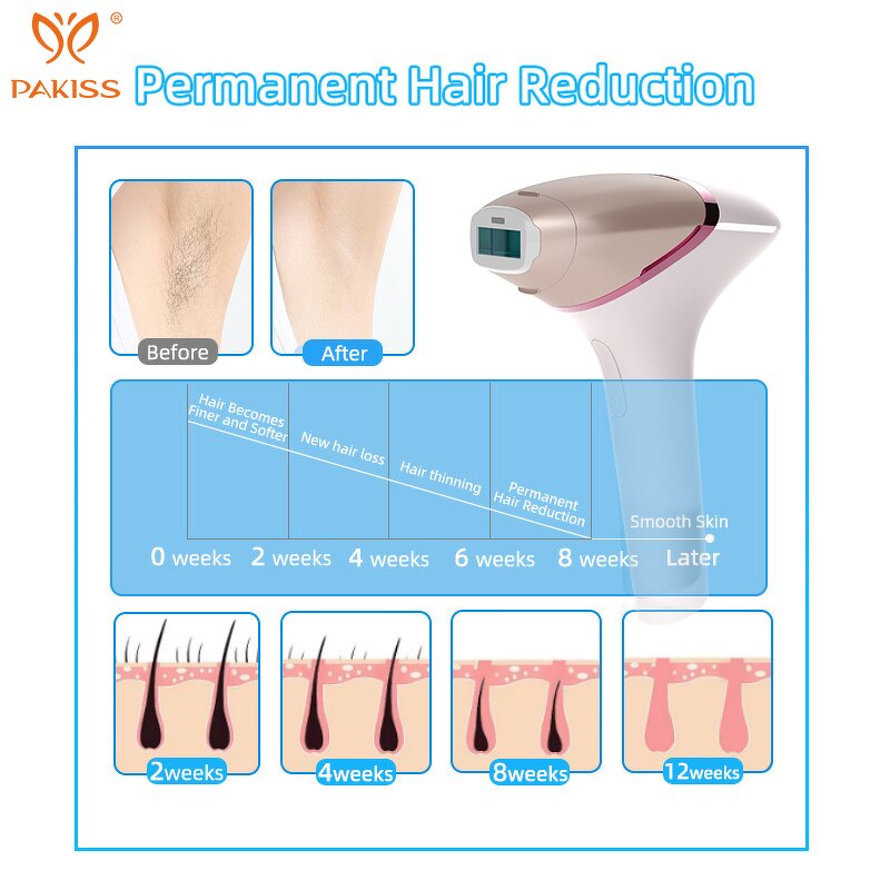 Battery IPL Hair Removal Device Manufacturer - Portable for Body Face