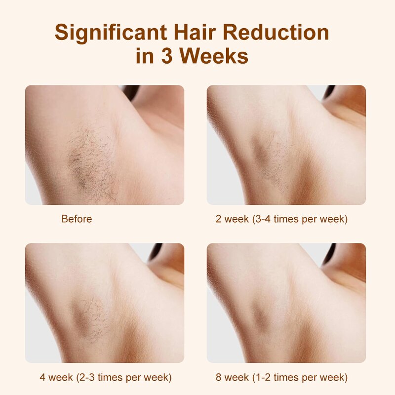 IPL Hair Removal Handset Manufacturer - OEM 510K Portable Home Use