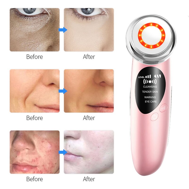 Skin Rejuvenation Massager Manufacturer - High Quality Ionic Photon Facial Lifting