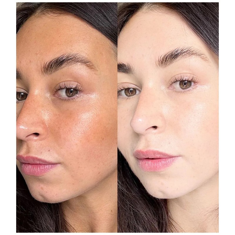 Vitamin C Capsules Factory - OEM VC Whitening Collagen