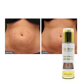 Stretch Mark Cream Manufacturer - Private Label Best