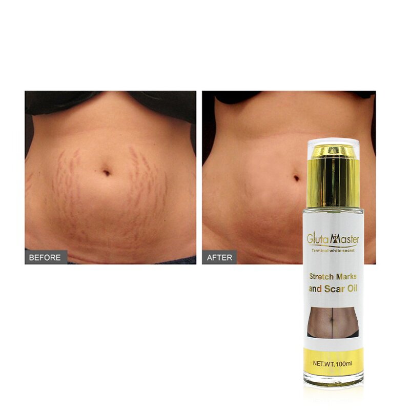 Stretch Mark Cream Manufacturer - Private Label Best