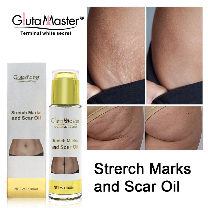 Stretch Marks Oil Manufacturer - Postpartum Hot Selling
