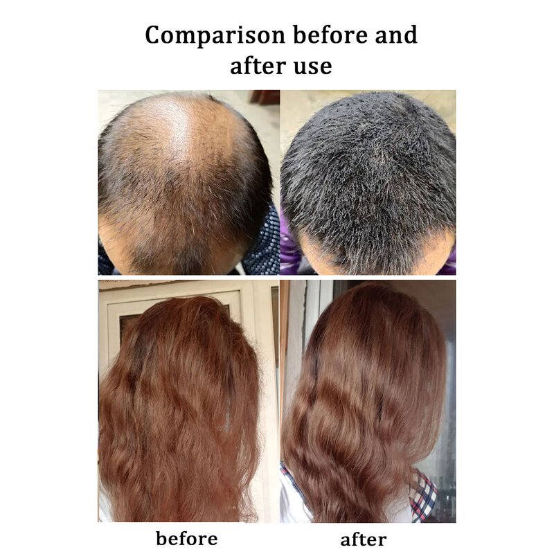 Anti Hair Loss Shampoo Manufacturer - Organic Natural