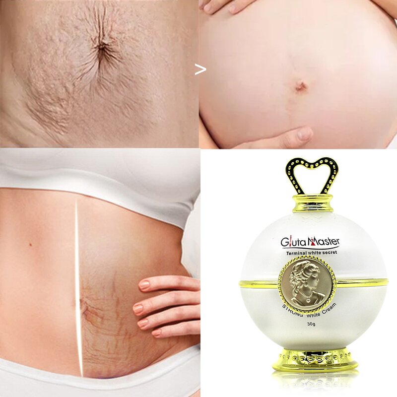 Stretch Mark Oil Manufacturer - Effective Repair