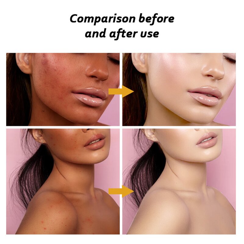 Face Whitening Cream Manufacturer - Private Label Gluta