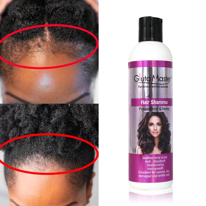 Hair Care Kit Manufacturer - Shampoo Conditioner Oil