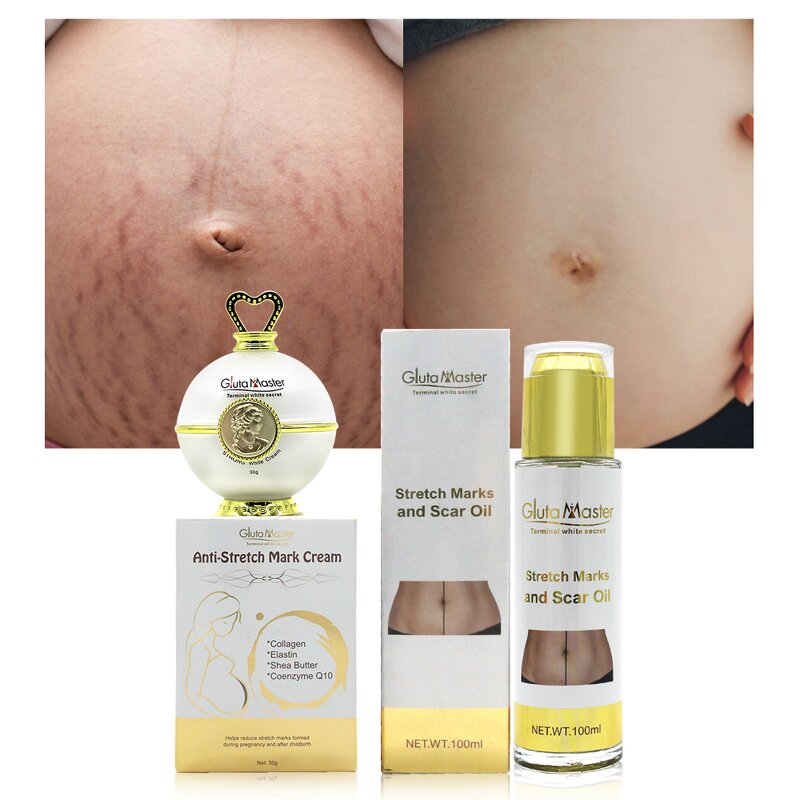 Stretch Marks Oil Manufacturer - Postpartum Hot Selling