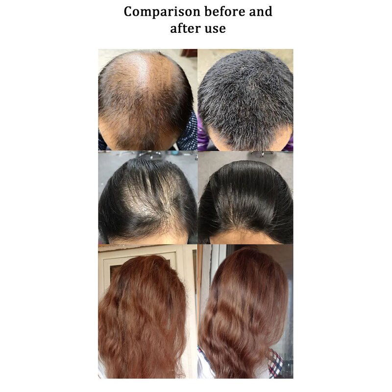 Hair Growth Oil Manufacturer - Wild Herbal Regrowth