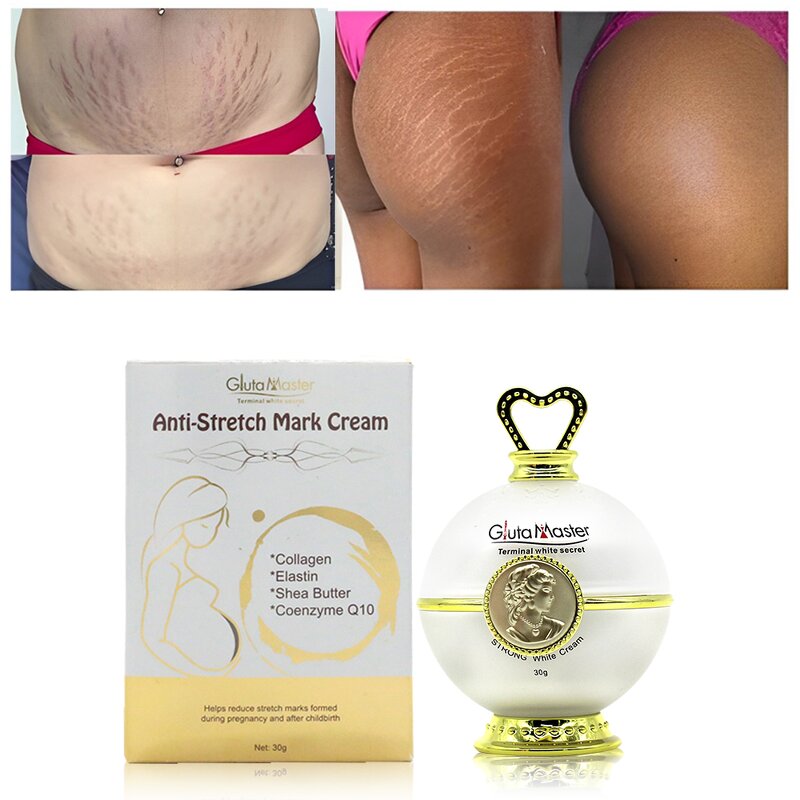 Stretch Marks Cream Manufacturer - Pregnancy Effective
