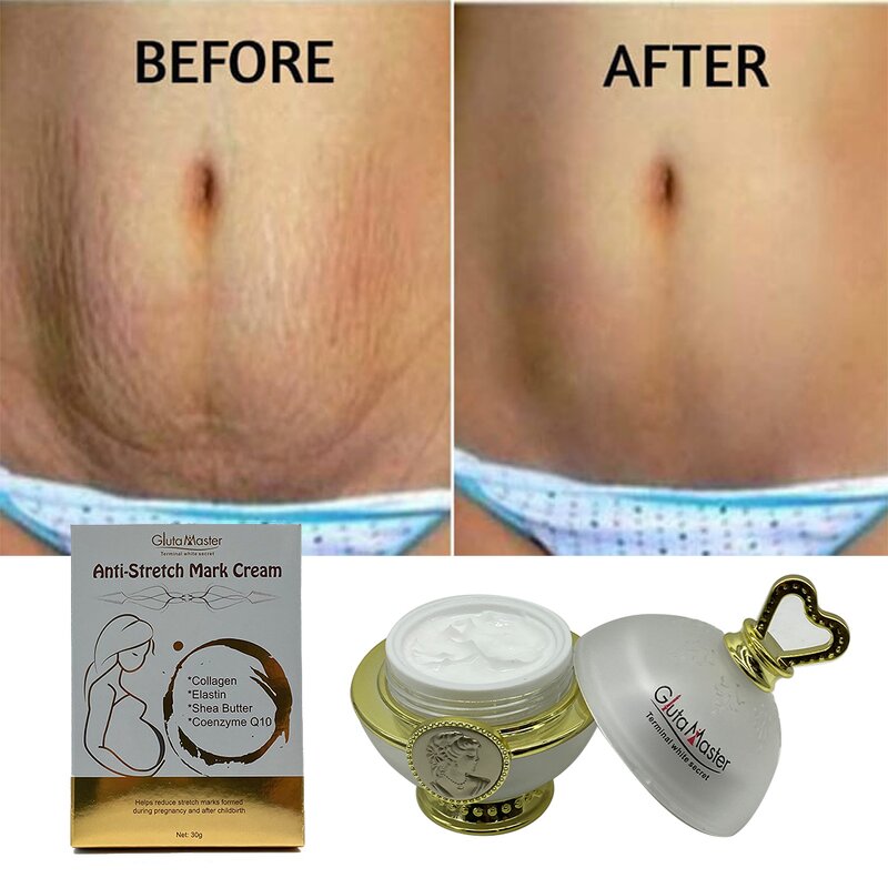 Stretch Marks Cream Manufacturer - Anti Scar Organic