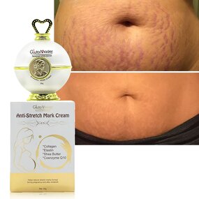 Stretch Marks Cream Manufacturer - Custom Logo Natural