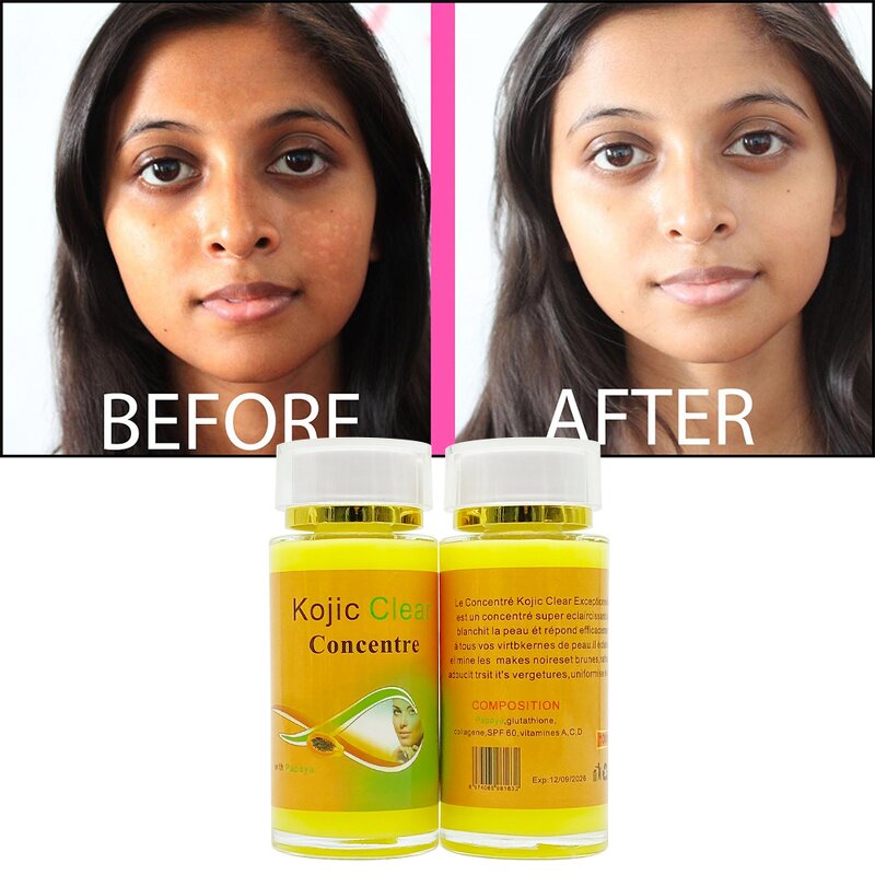 Yellow Kojic Serum Manufacturer - Papaya Concentre