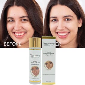 Clarifying Cleanser Manufacturer - Gluta Master Terminal