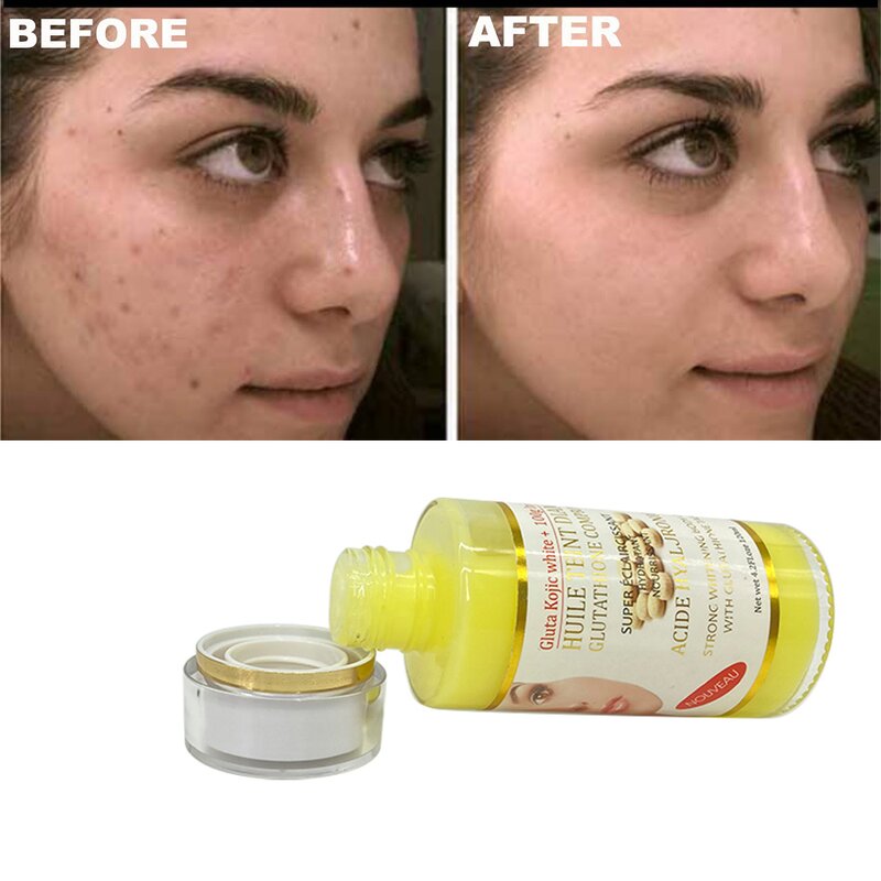 Skin Lightening Serum Manufacturer - Gluta Kojic White