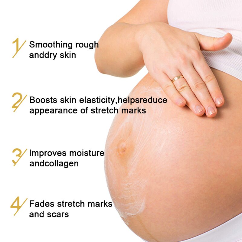 Stretch Marks Cream Manufacturer - High Quality Repair