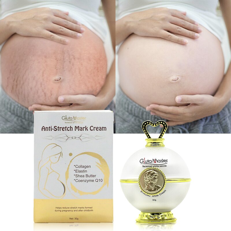 Stretch Marks Cream Manufacturer - Organic Natural