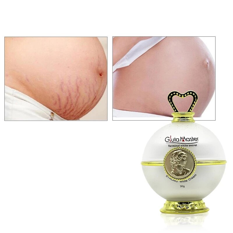 Stretch Marks Cream Manufacturer - Organic Natural