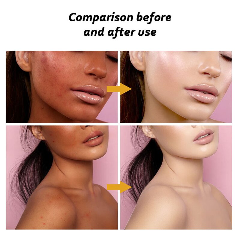 Skincare Set Manufacturer - Organic Whitening OEM