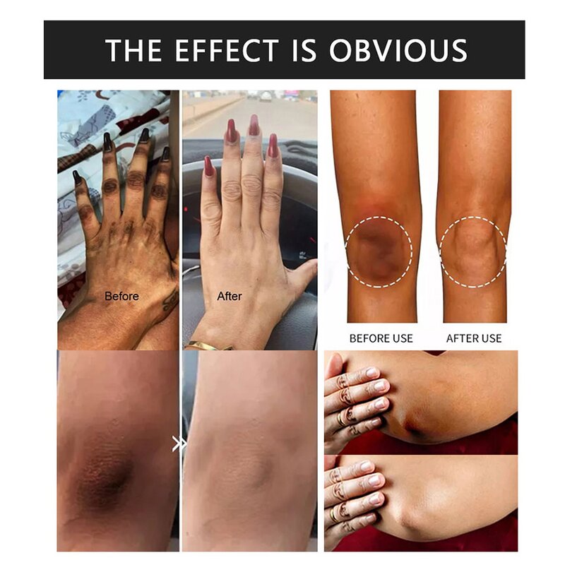 Whitening Supplement Manufacturer - Gluta White