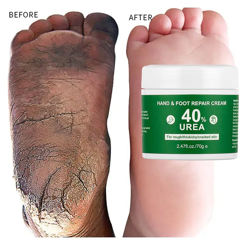 Foot Cream Manufacturer - Anti Fungal Repair