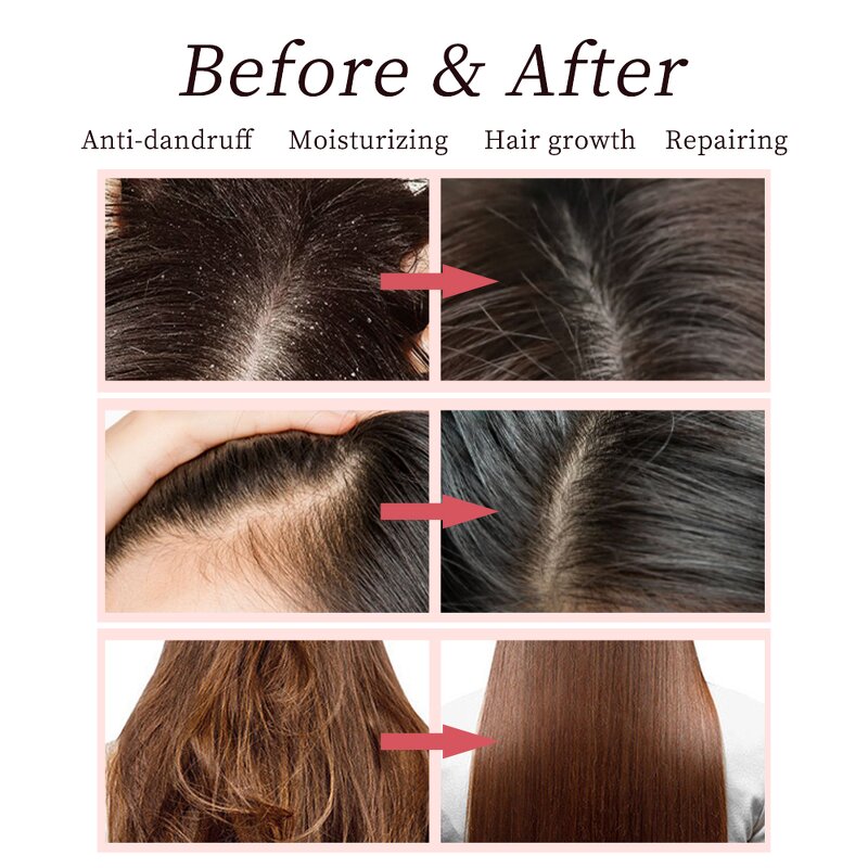 Hair Care Set Manufacturer - Hair Loss Repair