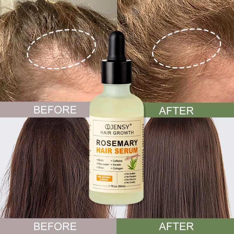 Hair Growth Serum Manufacturer - Heat Protection